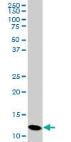PFN2 / Profilin 2 Antibody (clone 6G3)