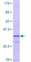 Human FOXS1 Protein (Recombinant GST, N-terminus)