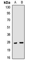 Polyclonal Rabbit anti-Human CLTA / LCA Antibody (WB)