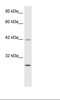 Polyclonal Rabbit anti-Human BTEB / KLF9 Antibody (aa38-87, IHC, WB)