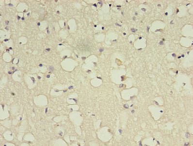 Polyclonal Rabbit anti-Human BDNF Antibody (IHC)