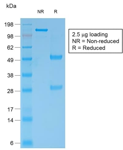 BCL2 / Bcl-2 Antibody (clone rBCL2/796, Azide-free, Carrier-free)
