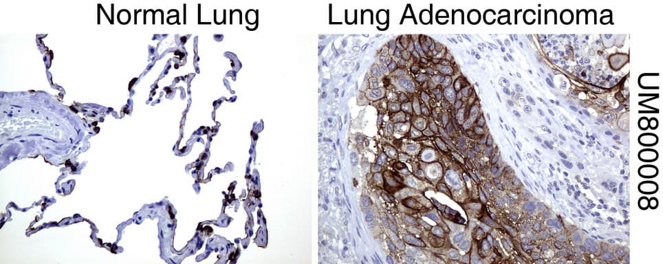 EMA / MUC1 Antibody (clone UMAB57)