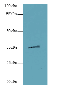 MED27 / CRSP8 Antibody