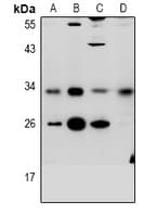 BTLA / CD272 Antibody
