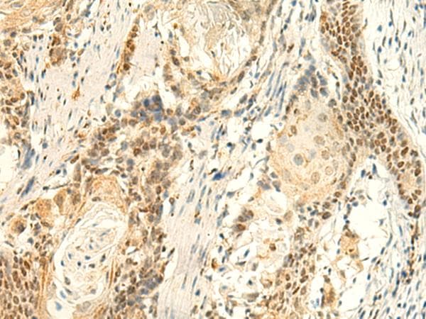 HMBOX1 Antibody