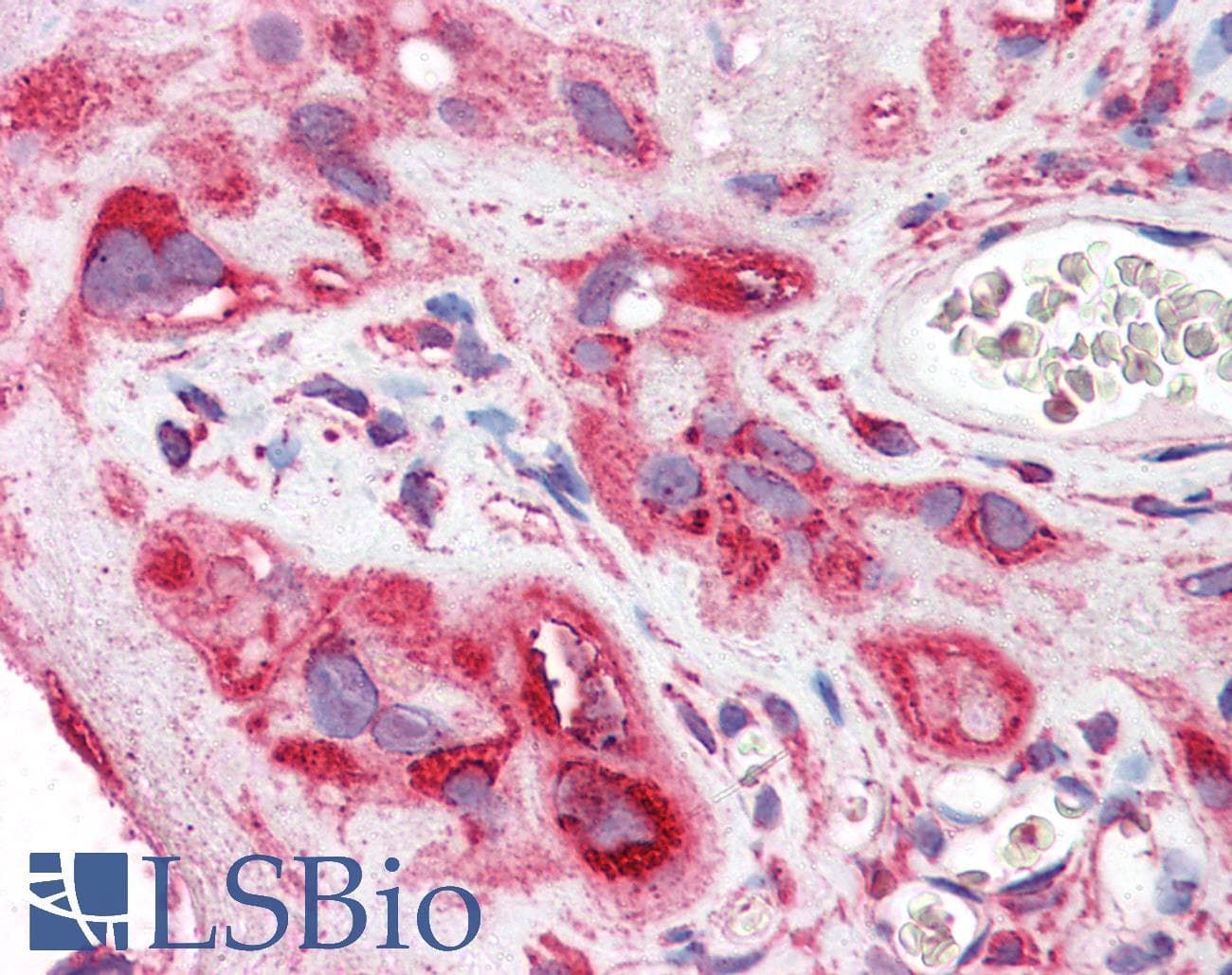 IHC-plus™ C5AR1 / CD88 / C5a Receptor Antibody (Azide-free)