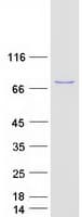 Human PLS1 / Fimbrin Protein (Recombinant Myc-DDK (Flag))