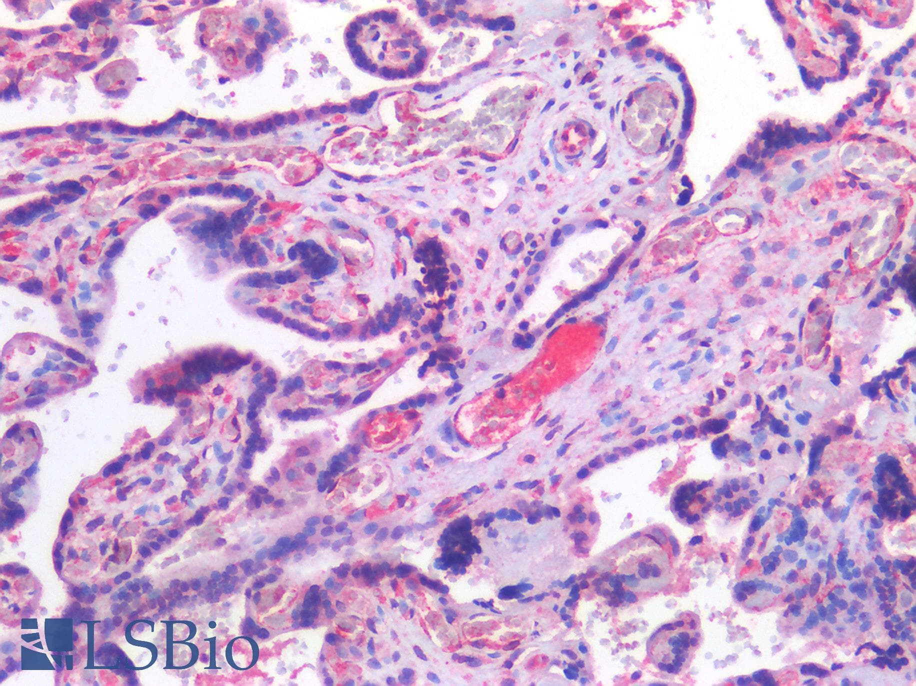 PathPlus™ CHAT Antibody (aa70-120)