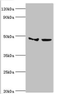 SMYD3 Antibody (aa199-428)