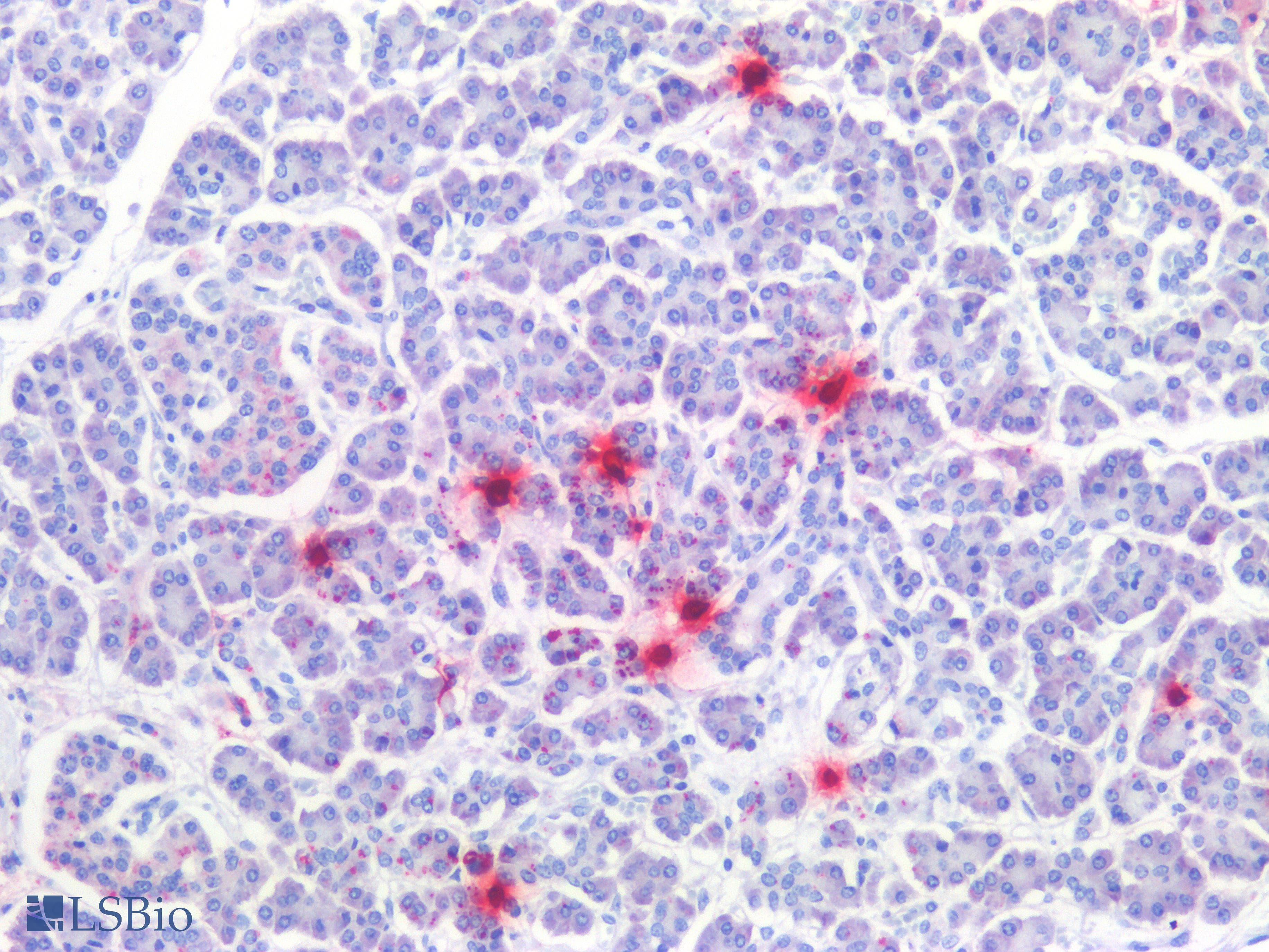 PathPlus™ TPSAB1 / Mast Cell Tryptase Antibody (clone 1.N.5)