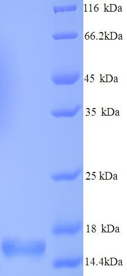 Human SNCA / Alpha-Synuclein Protein (Recombinant His)