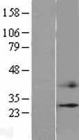 FSP27 / CIDEC Protein (Over-Expression Lysate Myc-DDK (Flag))