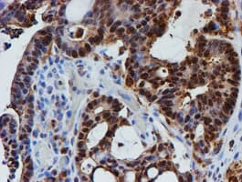 PSMB9 Antibody (clone OTI1G7)