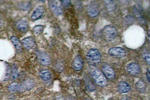 HSPB1 / HSP27 Antibody (phospho-Ser15)