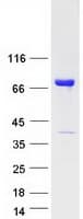 Human CRNN / Cornulin Protein (Recombinant Myc-DDK (Flag))