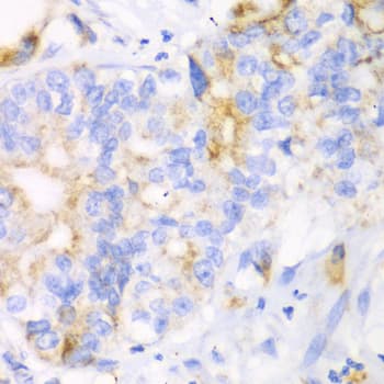 Polyclonal Rabbit anti-Human CHIA / Amcase Antibody (IHC, WB)