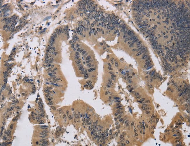 JAG1 / Jagged 1 Antibody