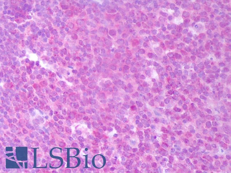 IHC-plus™ IL22 Antibody