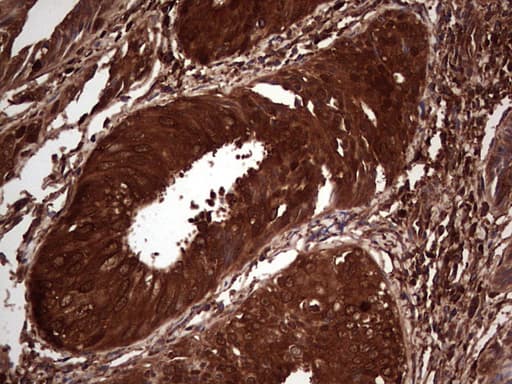 LGALS3 / Galectin 3 Antibody (clone OTI2F1)