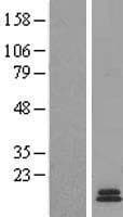 Human Gastrin Protein (Over-Expression Lysate Myc-DDK (Flag))