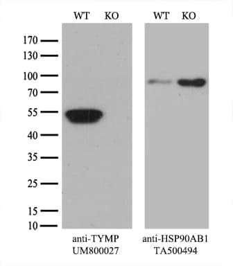 TP / Thymidine Phosphorylase Antibody (aa311-482, clone UMAB97)