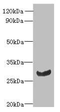 Polyclonal Rabbit anti-Human C11orf68 Antibody (IHC, WB)