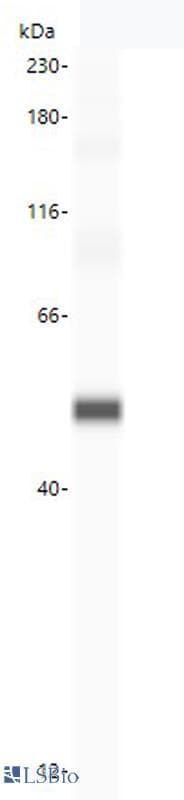 IHC-plus™ 5-Alpha Reductase / SRD5A1 Antibody