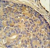 LOH12CR1 Antibody (aa167-196)