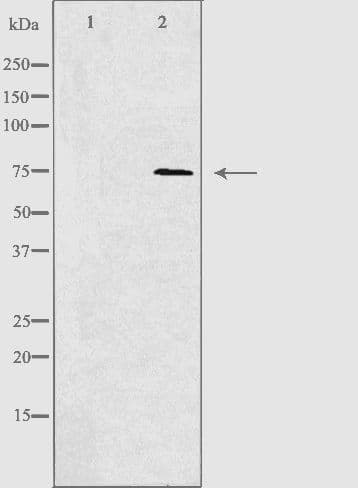 Polyclonal Rabbit anti-Human ARHGAP18 Antibody (IHC, IF, WB)