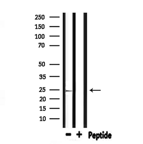 Polyclonal Rabbit anti-Human OPRS1 / SIGMAR1 Antibody (IHC, WB)