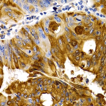 TFF1 / pS2 Antibody