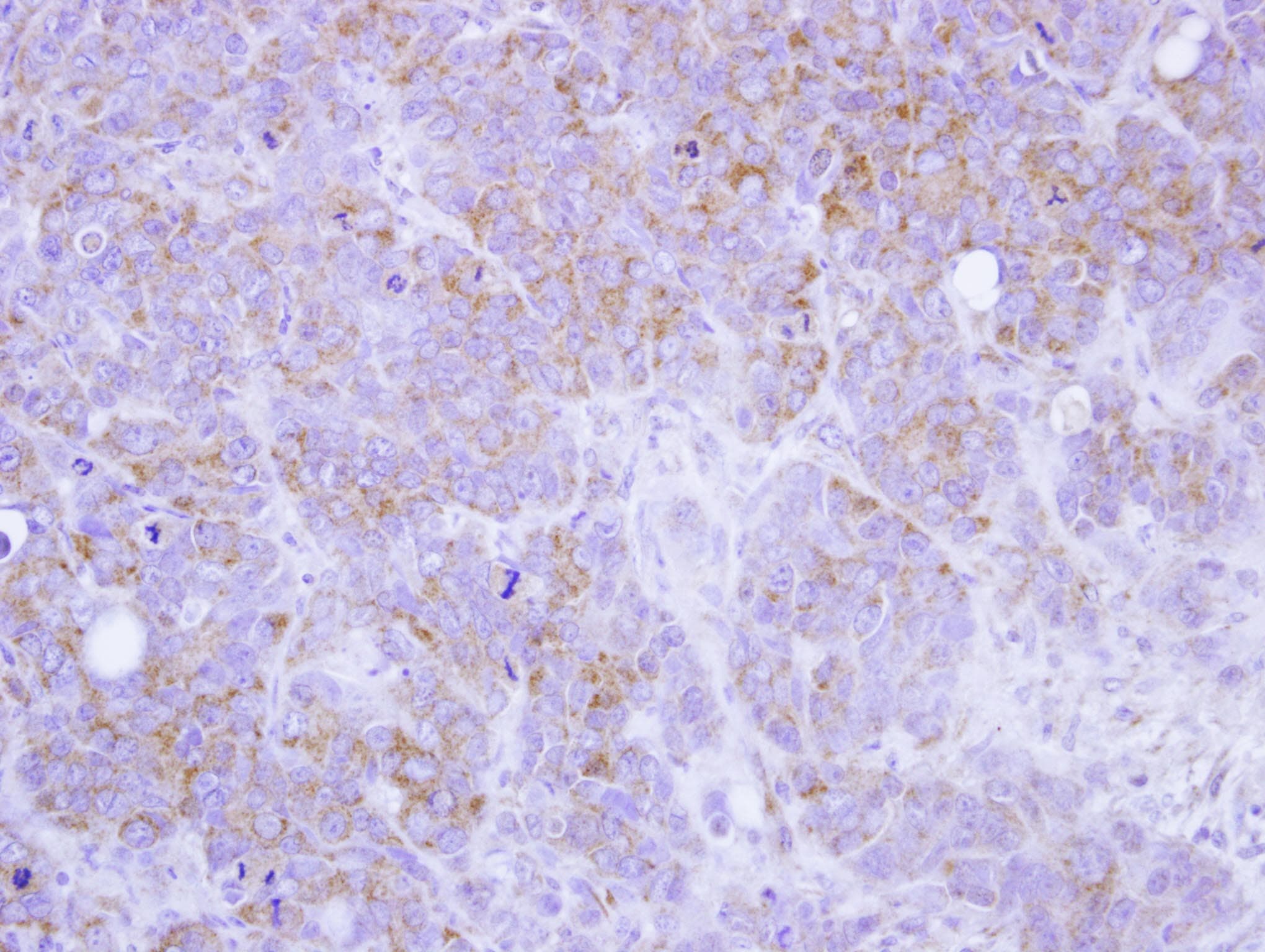 ST3GAL2 Antibody (aa68-327)