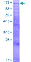Human TAOK3 / JIK Protein (Recombinant GST)