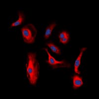Polyclonal Rabbit anti-Human ERBB3 / HER3 Antibody (C-Terminus, IHC, IF, WB)