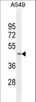 KDM8 / JMJD5 / FLJ13798 Antibody (aa36-63)