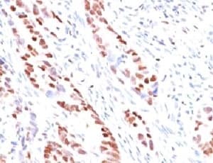 CDKN1C / p57 Kip2 Antibody (clone KIP57-1)