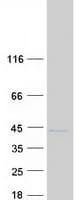 Human LGALS9C Protein (Recombinant Myc-DDK (Flag))