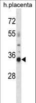 OR4K13 Antibody (aa65-93)