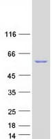 Human RAP1GDS1 / SmgGDS Protein (Recombinant Myc-DDK (Flag))