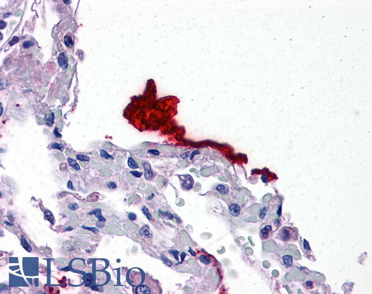 KLK6 / Kallikrein 6 Antibody (aa74-123)