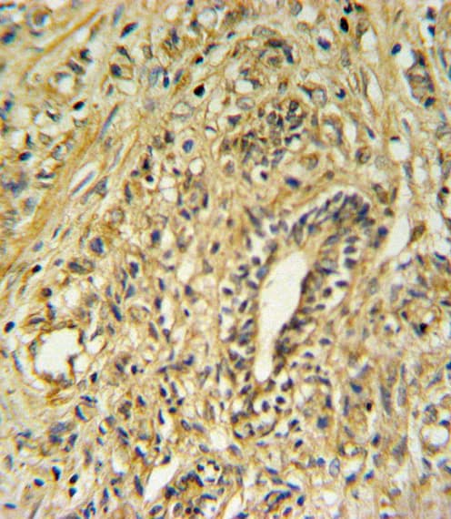 HSD17B2 Antibody (aa265-294)