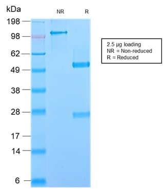 Recombinant Monoclonal Rabbit anti-Human GP2 Antibody (clone GP2/2569R, aa35-179, IHC)