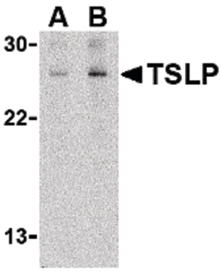 IHC-plus™ TSLP Antibody