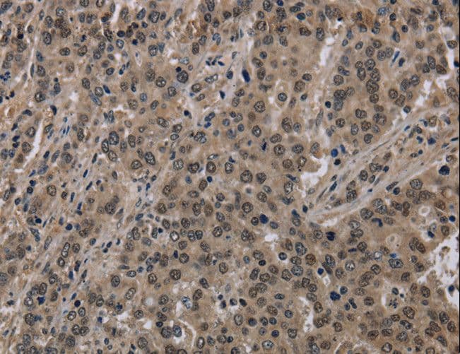 HIST1H2AH Antibody