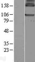 Human GABBR1 / GABA B Receptor 1 Protein (Over-Expression Lysate Myc-DDK (Flag))