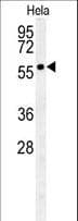 Polyclonal Rabbit anti-Human GALNT4 Antibody (aa93-120, WB)
