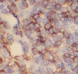 Monoclonal Mouse anti-Human TLR4 Antibody (IHC, WB)