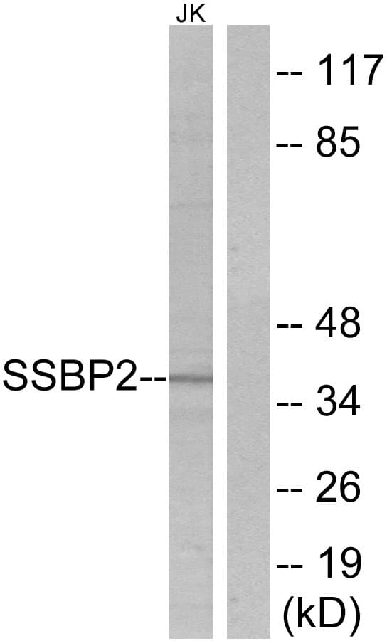 IHC-plus™ SSBP2 Antibody (aa10-59)