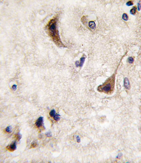 PTPN5 / STEP Antibody (aa168-198)